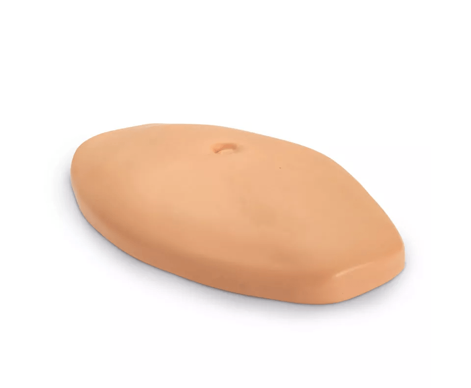 Injektionsbauch - Erler - Zimmer